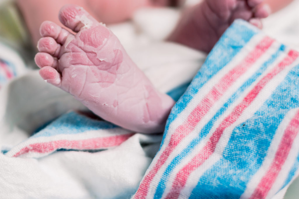 Newborn baby foot peeling